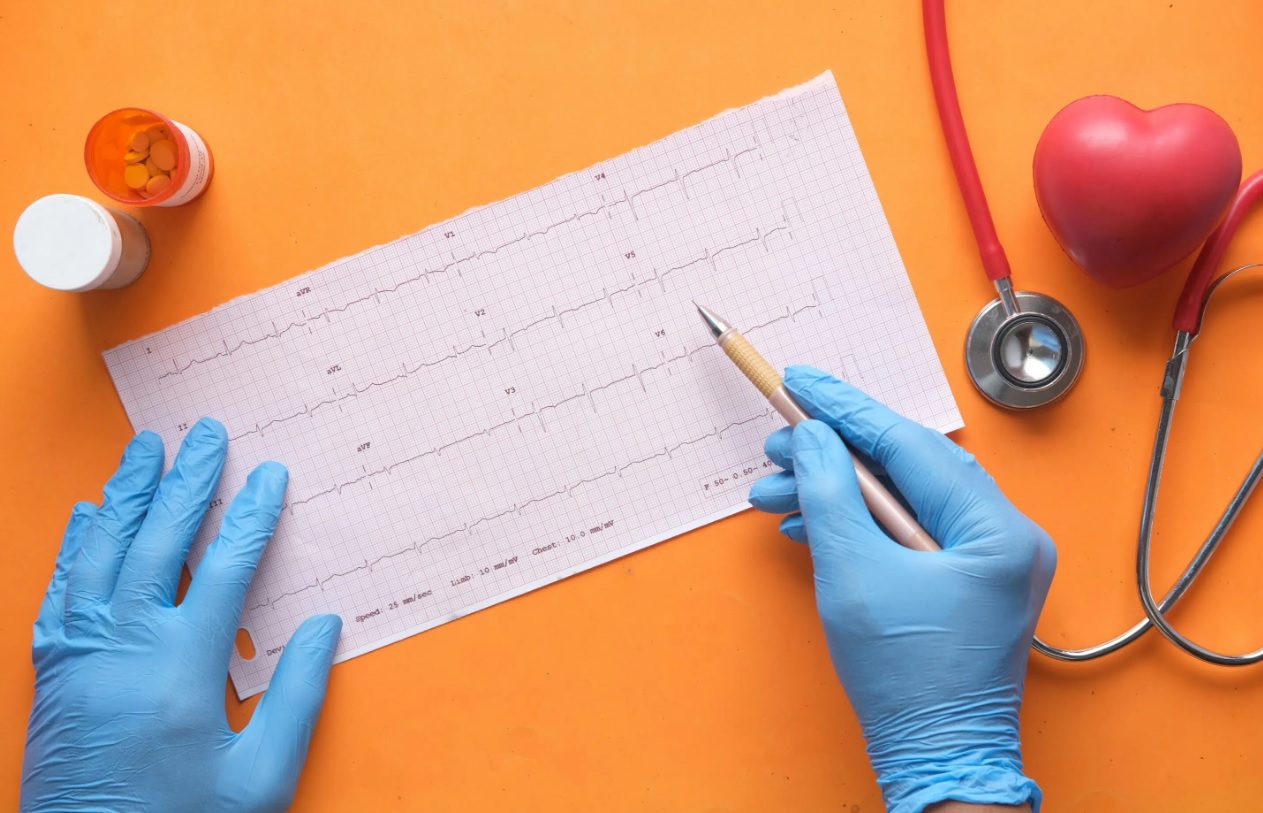 Heart Screening to Prevent Bangungot